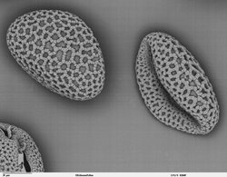 pollen of Lilium auratum (Oriental Lily) Back-scattered electron microscope image 